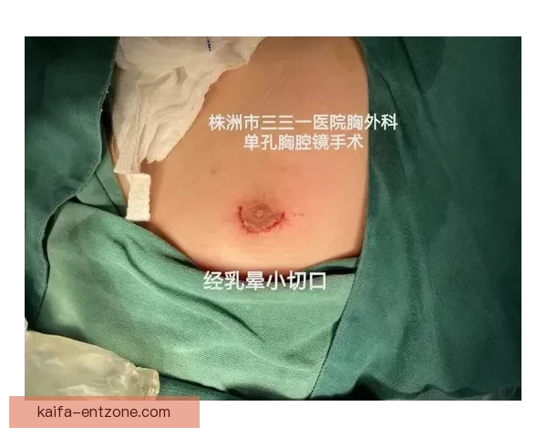 坎宁安气胸康复持续推进 活塞计划一周后复查评估