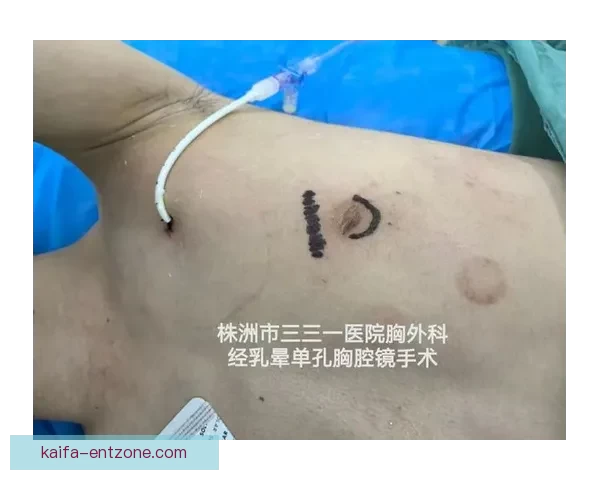 坎宁安气胸康复持续推进 活塞计划一周后复查评估